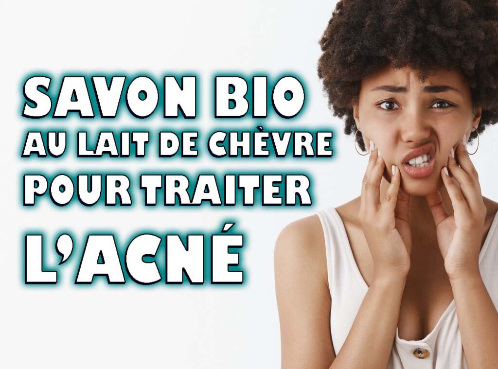 Utiliser le savon naturel et bio au lait de chèvre pour traiter l’acné